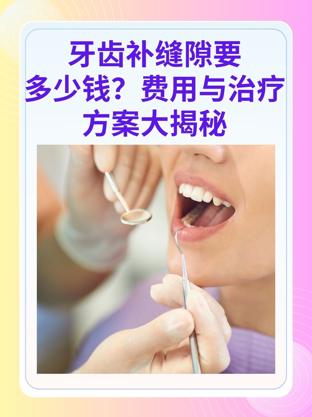 抚顺补牙医保可以报销吗(补牙医保可以报销吗 哪些可以报销呢)